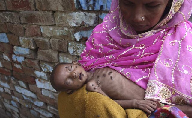 Naushad, 18-months-old and suffering from severe malnutrition, lies on his mother's lap inside their residence in Kalonda village near Sikandrabad district in the northern Indian start of Uttar Pradesh. Reuters Naushad, 18-months-old and suffering from severe malnutrition, lies on his mother's lap inside their residence in Kalonda village near Sikandrabad district in the northern Indian start of Uttar Pradesh. Reuters
