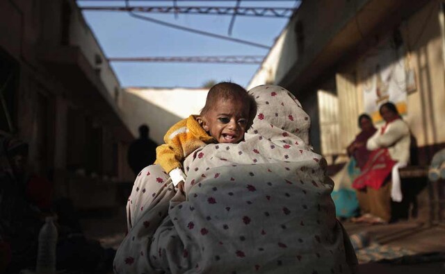 A woman holds her one-year-old granddaughter Sakshi, who weighs 3.8 kg (8 lbs) and suffers from severe malnutrition, at the Nutritional Rehabilitation Centre of Shivpuri district Madhya Pradesh. Reuters A woman holds her one-year-old granddaughter Sakshi, who weighs 3.8 kg (8 lbs) and suffers from severe malnutrition, at the Nutritional Rehabilitation Centre of Shivpuri district Madhya Pradesh. Reuters