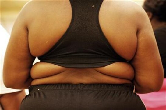 US cholesterol levels declining: Study