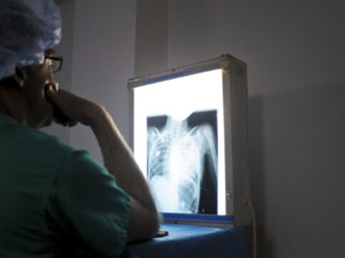 Delhi gangrape: How does a bone test determine age? Delhi gangrape: How does a bone test determine age?