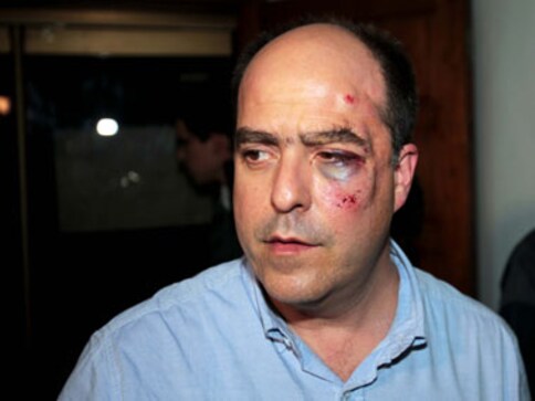 Politicians fight in Venezuela, one severely bruised