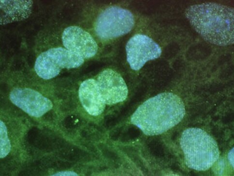 Massive breakthrough: Scientists create human liver from stem cells