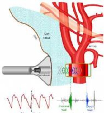 State-Of-The-Heart: How IIT Helps Combat Cardiovascular Diseases State-Of-The-Heart: How IIT Helps Combat Cardiovascular Diseases