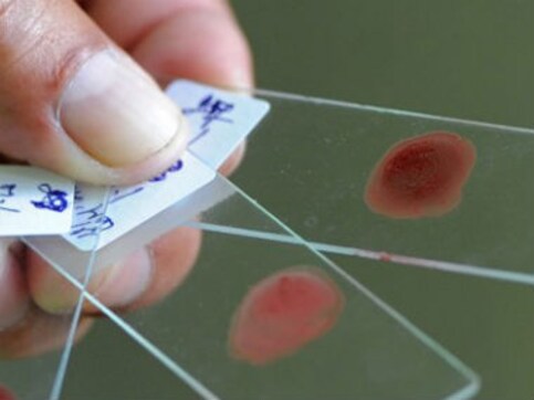 Novel blood test could predict if you'll die in next five years Novel blood test could predict if you'll die in next five years