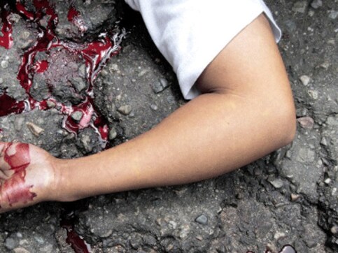 Amritsar: Teen sets mother afire, beats her to death over suspected affair Amritsar: Teen sets mother afire, beats her to death over suspected affair