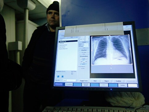 Now detect tumours with radiation-free scanning technique Now detect tumours with radiation-free scanning technique