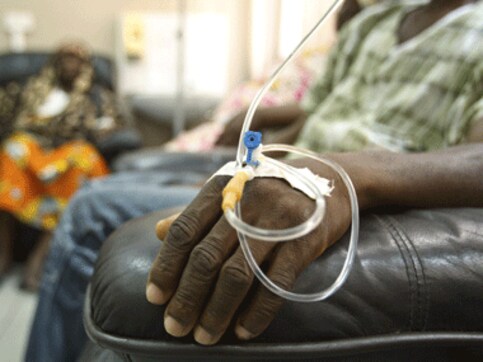 Vitamin C helps chemotherapy process to kill cancer cells: Study Vitamin C helps chemotherapy process to kill cancer cells: Study
