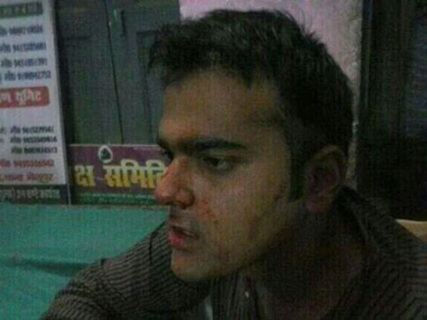 AAP: 'BJP goons' are responsible for the attack on party workers in Varanasi AAP: 'BJP goons' are responsible for the attack on party workers in Varanasi