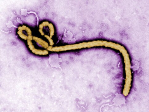 Nigerian headed to India dies of suspected Ebola in Abu Dhabi Nigerian headed to India dies of suspected Ebola in Abu Dhabi