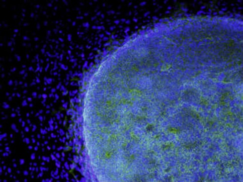 Scientists in UK create artificial egg and sperm using stem cells Scientists in UK create artificial egg and sperm using stem cells