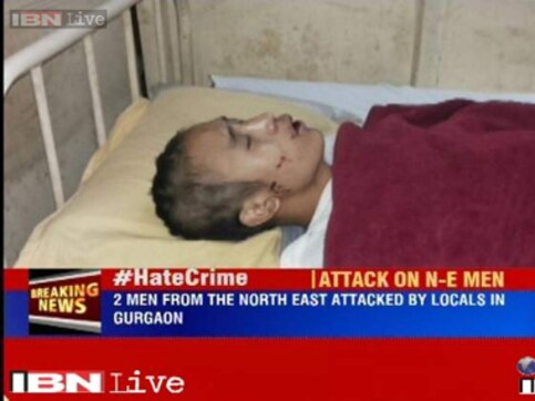 3 Nagaland men beaten up, heads shaved in Gurgaon for refusing to drink 3 Nagaland men beaten up, heads shaved in Gurgaon for refusing to drink