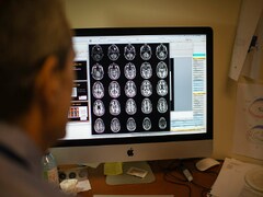 'Lost' memories of Alzheimer's patients may be recoverable, finds new study