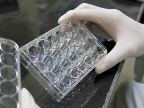 Scientists at National Institute of Virology discover new genotype of the Dengue virus