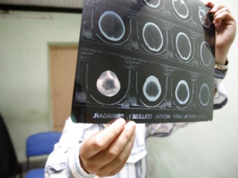 Mental Healthcare Bill: Despite the positive reform, a lot more needs to be done for the mentally ill Mental Healthcare Bill: Despite the positive reform, a lot more needs to be done for the mentally ill