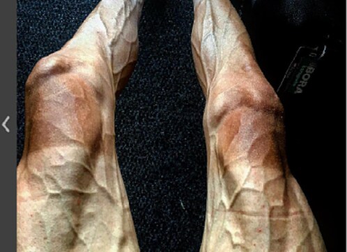 Tour de France 2017: Cyclist Pawel Poljanski's vein-popping legs send social media into frenzy Tour de France 2017: Cyclist Pawel Poljanski's vein-popping legs send social media into frenzy