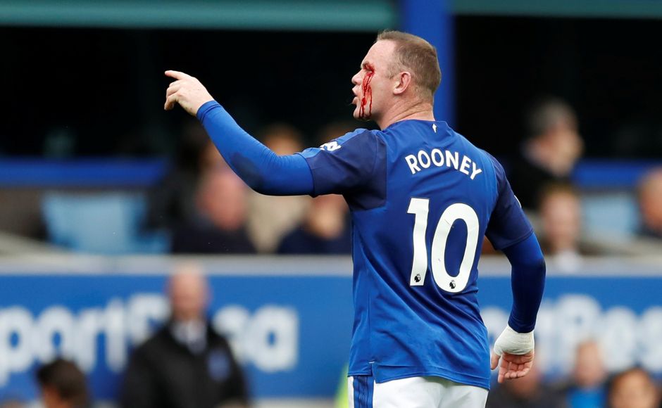 Everton got back to winning ways with narrow win over Bournemouth in a game that saw Wayne Rooney suffering a cut just above his eye. Reuters Manchester City, United continue good start, Alvaro Morata hat-trick powers Chelsea past Stoke in Premier League