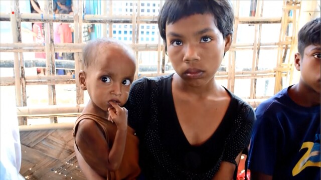 Safe in a camp, Rohingya children face death by malnutrition Safe in a camp, Rohingya children face death by malnutrition
