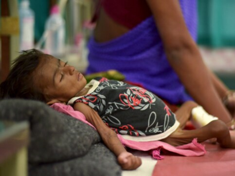 India improved its infant mortality rate, yet has highest number of malnourished children in the world: Report India improved its infant mortality rate, yet has highest number of malnourished children in the world: Report