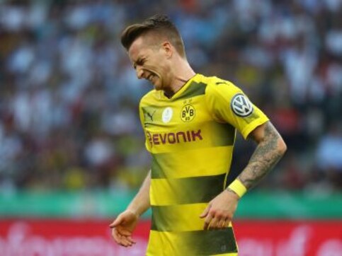 Champions League: Dortmund will not rush Marco Reus' return from injury for Real Madrid clash Champions League: Dortmund will not rush Marco Reus' return from injury for Real Madrid clash