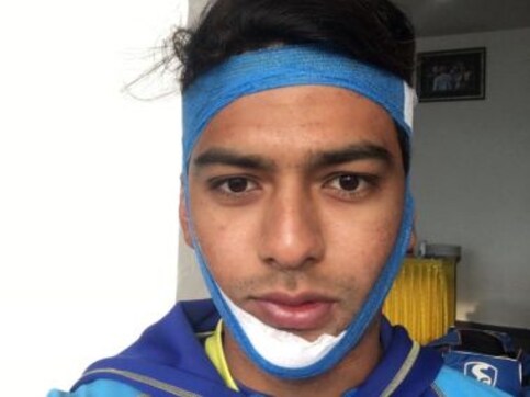 Vijay Hazare Trophy: Unmukt Chand slams century with broken jaw to help Delhi beat Uttar Pradesh Vijay Hazare Trophy: Unmukt Chand slams century with broken jaw to help Delhi beat Uttar Pradesh
