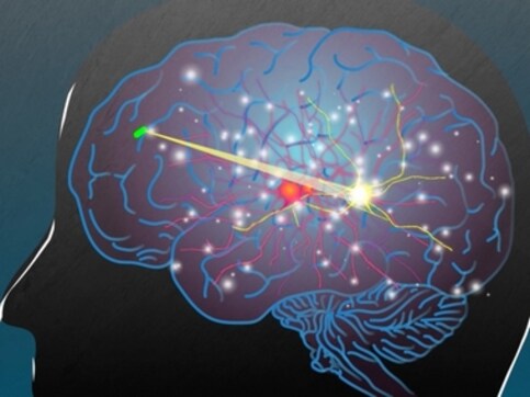 Scientists have found a way to wirelessly charge devices implanted within the human body Scientists have found a way to wirelessly charge devices implanted within the human body