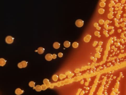 E Coli outbreak: 5 dead in the US, romaine lettuce from Arizona likely to be the cause E Coli outbreak: 5 dead in the US, romaine lettuce from Arizona likely to be the cause