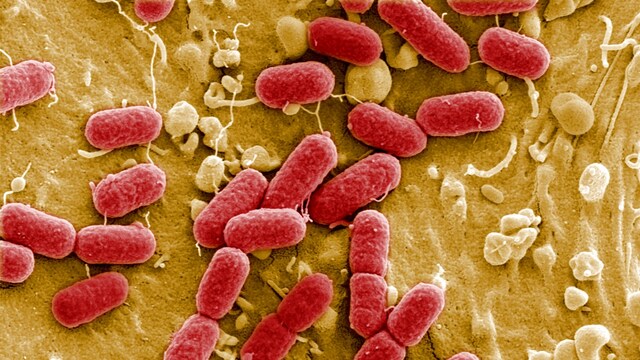 Researchers use CRISPR gene editing to disrupt antibiotic-resistance in bacteria Researchers use CRISPR gene editing to disrupt antibiotic-resistance in bacteria