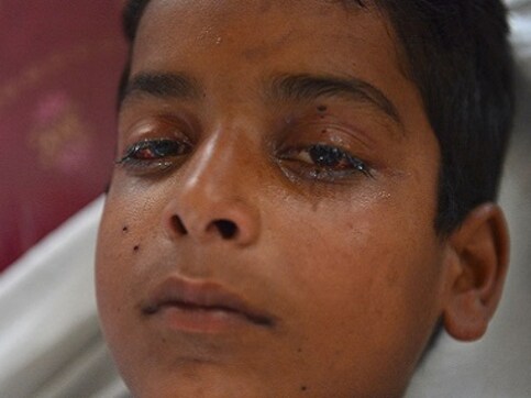Kashmir's pellet-hit youth paint pale picture of government apathy, unkept promises and torment by police Kashmir's pellet-hit youth paint pale picture of government apathy, unkept promises and torment by police