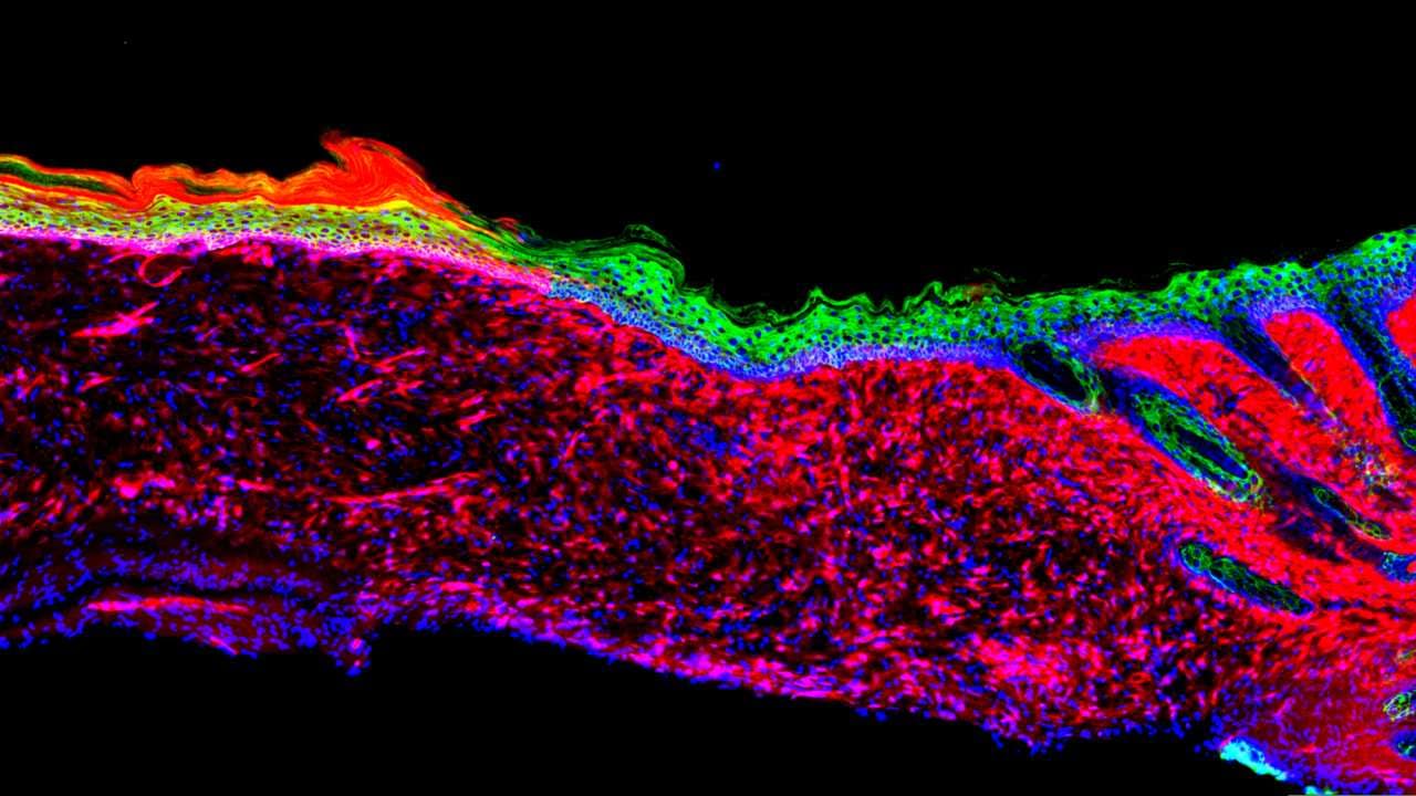 Cells in a wound reprogrammed into skin cells in a revolutionary new technique