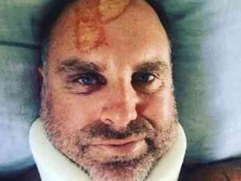 Matthew Hayden suffers spinal fracture while surfing in Queensland Matthew Hayden suffers spinal fracture while surfing in Queensland