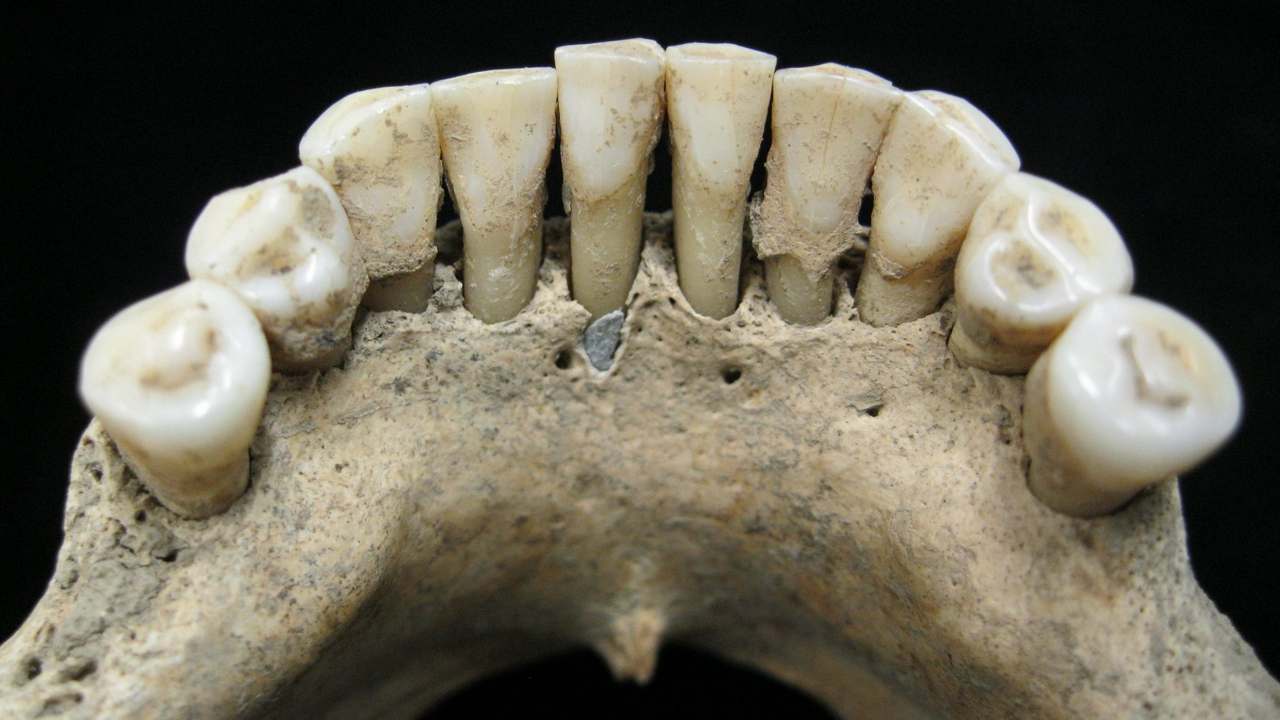 This undated photo released by the Max Planck Institute for the Science of Human History in Jena, Germany, shows the dental calculus on the lower jaw where a medieval woman entrapped lapis lazuli pigment, seen below center tooth. The semi-precious stone was highly prized at the time for its vivid color and was ground up and used as a pigment. From this discovery, scientists concluded the woman was an artist involved in creating illuminated manuscripts, a task usually associated with monks. The find is considered the most direct evidence yet of a woman taking part in the making of high-quality illuminated manuscripts, the lavishly illustrated religious and secular texts of the Middle Ages. And it corroborates other findings that suggest female artisans were not as rare as previously thought. (Christina Warinner/Max Planck Institute for the Science of Human History via AP)
