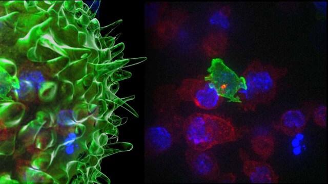 Decoy bacteria and tiny 'nanobodies' paired up to fight cancer in new technique Decoy bacteria and tiny 'nanobodies' paired up to fight cancer in new technique