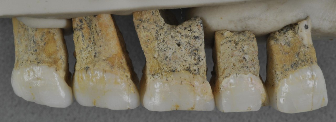 The gorgeous teeth our beloven homo luzonensis relatives wore. Image: AFP