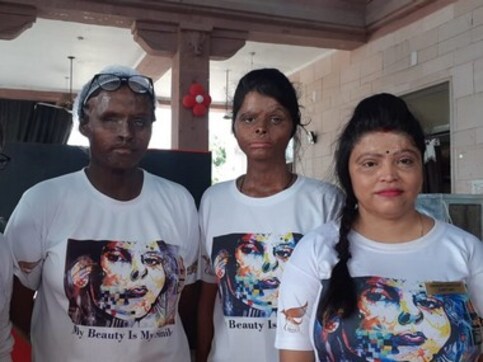 For acid attack survivors, 2019 elections emerge as platform to campaign for stronger laws, proper treatment and compensation For acid attack survivors, 2019 elections emerge as platform to campaign for stronger laws, proper treatment and compensation