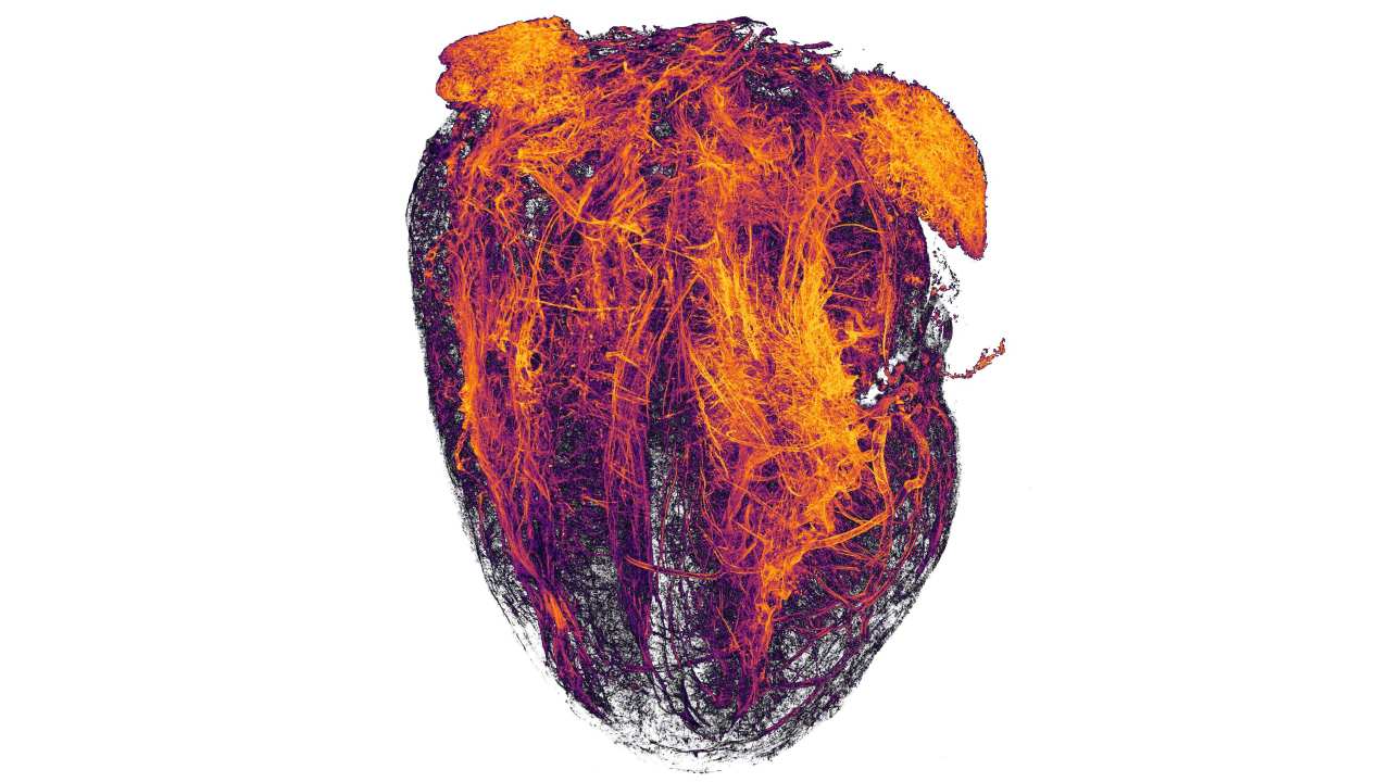 In 20th place, blood vessels of a mouse heart following a heart attack. Image credit: Simon Merz Lea Bornemann, Sebastian Korste/Nikon Small World