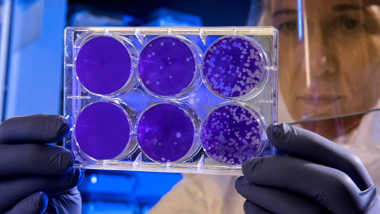 The virus has caused alarm because of its connection to SARS (Severe Acute Respiratory Syndrome) which killed nearly 650 people in China and Hong Kong in 2002-2003.