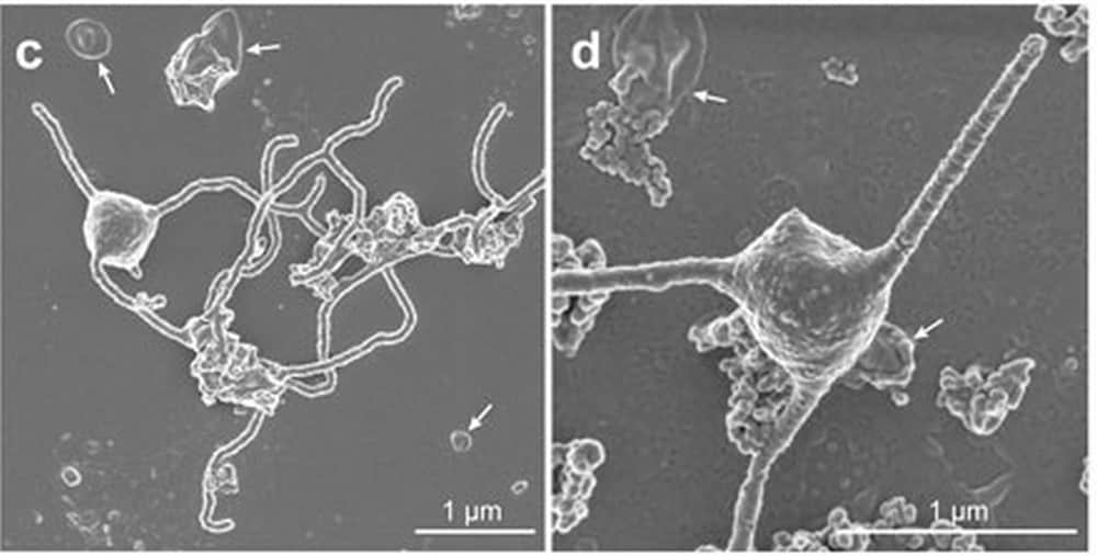 A scanning electron microscopy image of the single-celled organism Prometheoarchaeum syntrophicum strain MK-D1 showing the cell with tentacle-like branching protrusions. Image credit: JAMSTEC