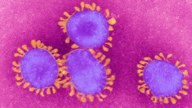 Coronavirus outbreak: Rapid infection, virus' evasive nature, gaps in testing make outbreak control particularly challenging Coronavirus outbreak: Rapid infection, virus' evasive nature, gaps in testing make outbreak control particularly challenging