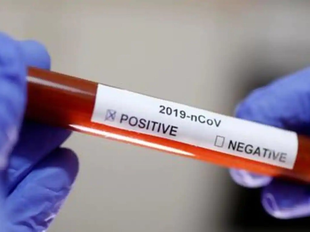 India's third case of coronavirus was confirmed in kerala by the Health Min on Monday, 2 February 2020. Image: PTI