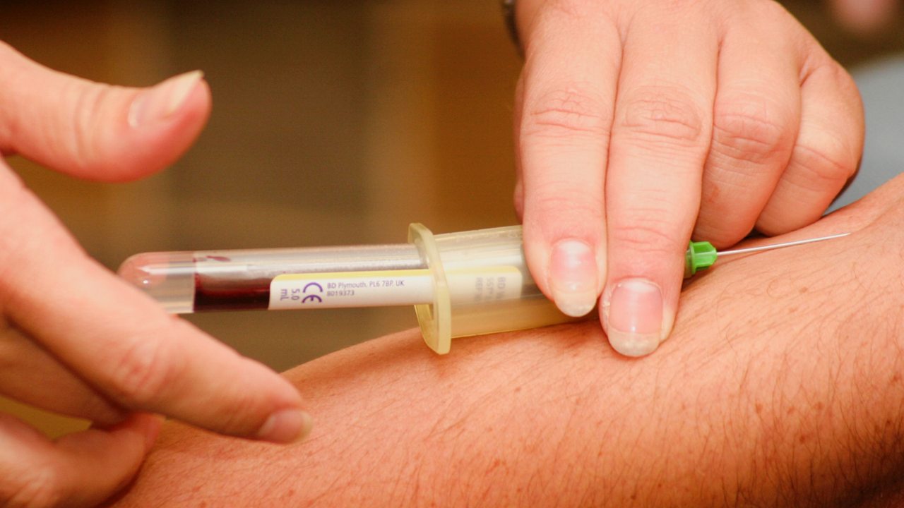 ICMR strongly appeals those private laboratories should offer COVID-19 diagnosis at no cost."