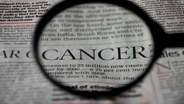 Wearable device for melanoma treatment: Scientists develop a nanoneedle skin patch for this aggressive form of cancer Wearable device for melanoma treatment: Scientists develop a nanoneedle skin patch for this aggressive form of cancer