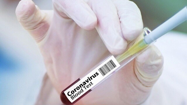 Recovered COVID-19 patients should donate plasma soon, antibodies may decline in 2-4 months, scientists say