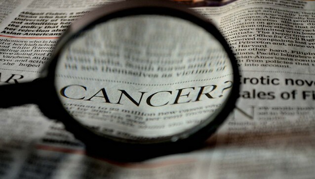 Meet STING: Scientists identify natural immune-boosting protein that could promote anti-cancer immunity Meet STING: Scientists identify natural immune-boosting protein that could promote anti-cancer immunity