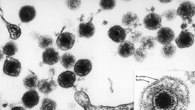 First-ever vaccine against HHV6B herpes virus shows promising results in mice; all you need to know First-ever vaccine against HHV6B herpes virus shows promising results in mice; all you need to know