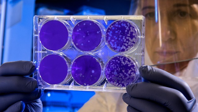 New study reveals why different people experience varying intensity of COVID-19 symptoms