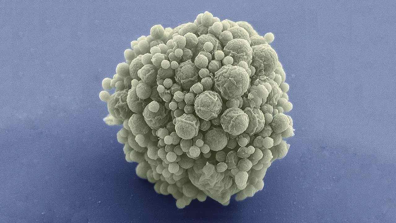 Synthetic bacteria-like minimal cell can now divide, grow like natural cells do