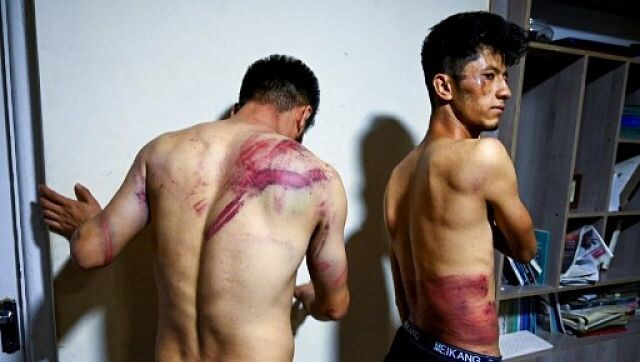 'They kicked me in the head': Afghan journalists recall Taliban beatings after covering women's protests