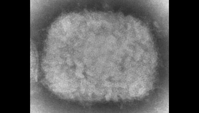 Israel reports first case of monkeypox, suspects others as virus spreads Israel reports first case of monkeypox, suspects others as virus spreads