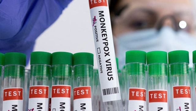 China reports its first monkeypox case in Chongqing city