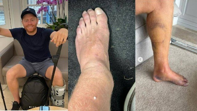 England batter Jonny Bairstow out until 2023 after breaking leg in golf accident England batter Jonny Bairstow out until 2023 after breaking leg in golf accident